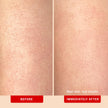 First Aid Beauty - KP Bump Eraser Body Scrub with 10% AHA, Keratosis Pilaris Skin Exfoliator with Glycolic and Lactic acids, Helps Reduce Chicken Skin Bumps, Safe for Sensitive Skin, 8 oz